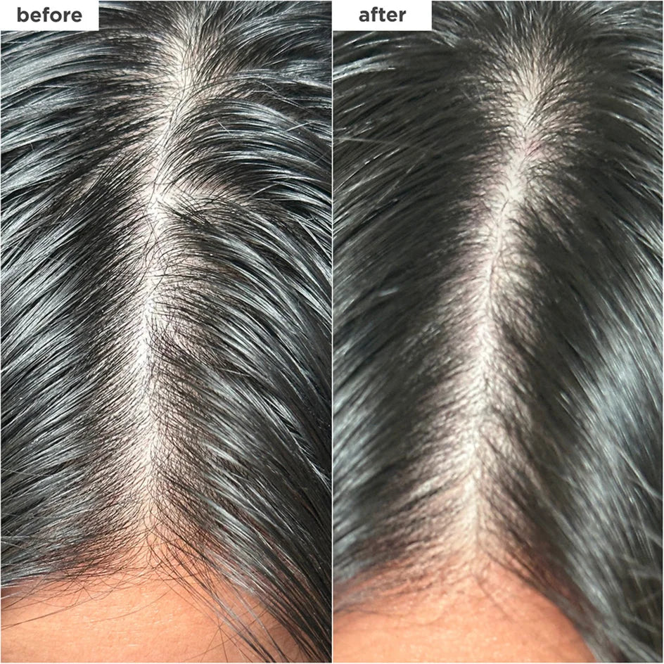 Briogeo Scalp Revival Charcoal + Biotin Dry Shampoo 50ml