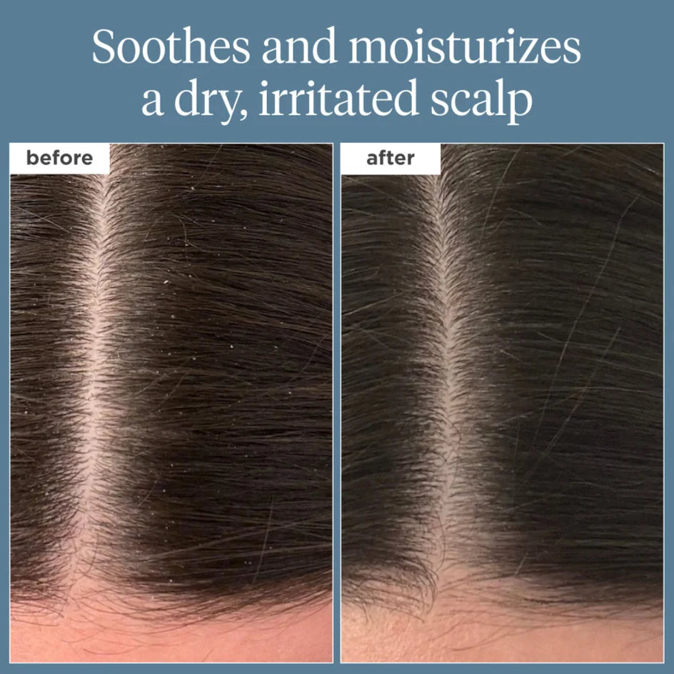 Briogeo Scalp Revival Rosemary Pre-wash Oil For Hair And Scalp 100ml
