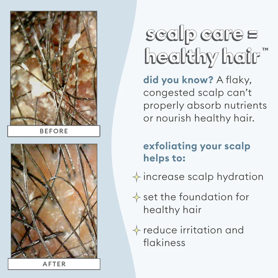 Briogeo Scalp Revival Charcoal + Coconut Oil Micro-exfoliating Shampoo 236ml