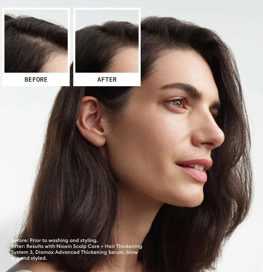 Nioxin Scalp & Hair Thickening System Kit 3 - For Colour Treated Hair With Light Thinning