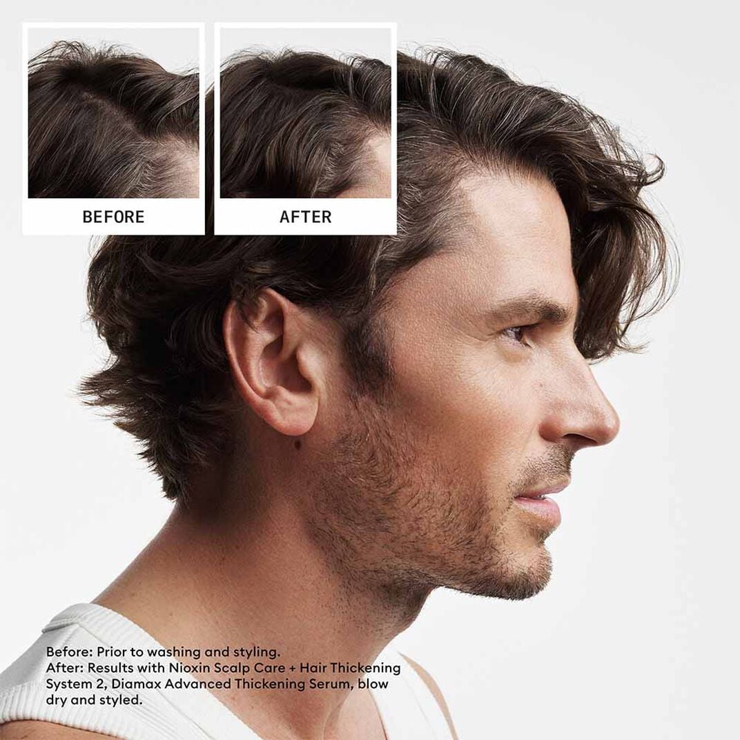 Nioxin Scalp & Hair Thickening System Kit 2 - For Natural Hair With Progressed Thinning