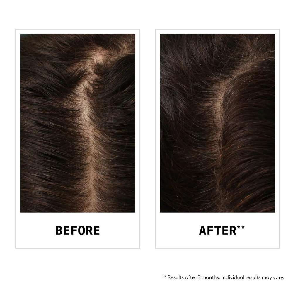 Nioxin Anti Hair Fall Defense Shampoo